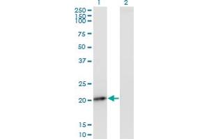 Western Blot analysis of PMVK expression in transfected 293T cell line by PMVK monoclonal antibody (M07A), clone 2B8.