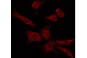 ABIN6276103 staining COLO205 by IF/ICC. (OPN4 antibody  (C-Term))