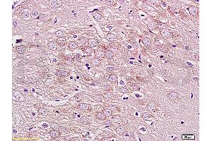 Formalin-fixed and paraffin embedded rat brain labeled with Rabbit Anti GPRIN1 Polyclonal Antibody, Unconjugated (ABIN872320) at 1:200 followed by conjugation to the secondary antibody and DAB staining (GPRIN1 antibody  (AA 101-200))