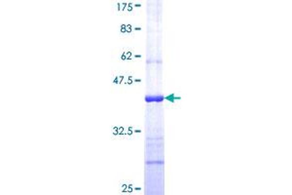 INHBB Protein (AA 298-407) (GST tag)