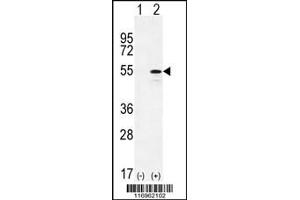 Western blot analysis of CYP26B1 using rabbit polyclonal CYP26B1 Antibody using 293 cell lysates (2 ug/lane) either nontransfected (Lane 1) or transiently transfected (Lane 2) with the CYP26B1 gene.