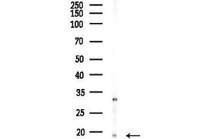 anti-P18 INK antibody