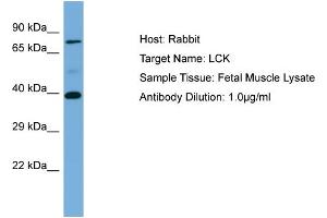 Host: Rabbit Target Name: LCK Sample Type: Fetal Muscle lysates Antibody Dilution: 1. (LCK antibody  (N-Term))