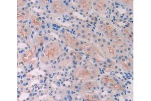 Figure. (LRPAP1 antibody  (AA 184-298))