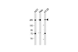 Western Blot at 1:2000 dilution Lane 1: A431 whole cell lysate Lane 2: Hela whole cell lysate Lane 3: HT-29 whole cell lysate Lysates/proteins at 20 ug per lane. (Myosin 9 antibody  (C-Term))