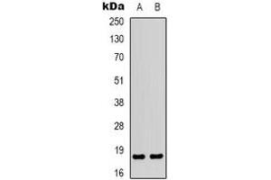 Western blot analysis of MYL9 expression in Jurkat (A), COLO205 (B) whole cell lysates. (MYL9 antibody  (N-Term))