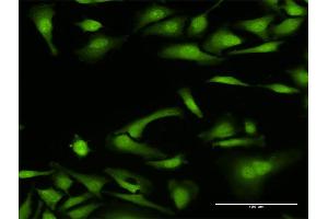 Immunofluorescence of purified MaxPab antibody to NCF4 on HeLa cell. (NCF4 antibody  (AA 1-339))