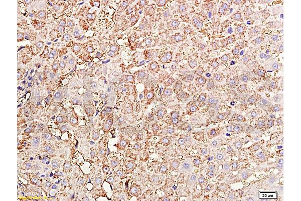 TIMP1 antibody  (AA 103-207)