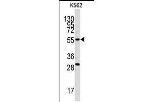 Western blot analysis of anti-CLIC5 Antibody in K562 cell line lysates (35ug/lane). (CLIC5 antibody)