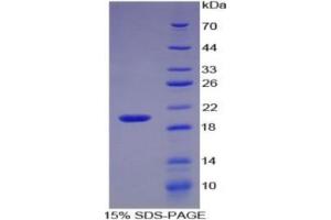 SDS-PAGE of Protein Standard from the Kit  (Highly purified E. (IL-17 ELISA Kit)