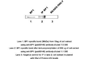Image no. 1 for anti-Distal-Less Homeobox 4 (DLX4) (AA 1-60) antibody (ABIN363455)