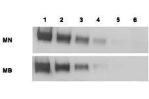 Western Blotting (WB) image for anti-Mesothelin (MSLN) (Extracellular Domain) antibody (ABIN400815) (Mesothelin antibody  (Extracellular Domain))
