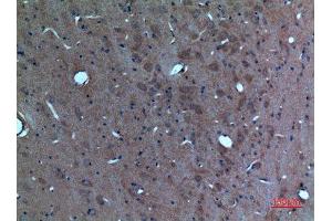 Immunohistochemistry (IHC) analysis of paraffin-embedded Rat Brain, antibody was diluted at 1:100. (SCG3 antibody  (N-Term))