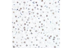 Immunohistochemistry of paraffin-embedded rat liver using SP1 Rabbit pAb (ABIN7270506) at dilution of 1:50 (40x lens). (SP1 antibody  (AA 420-620))