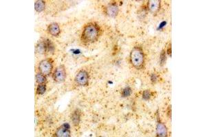 Immunohistochemical analysis of CD226 staining in human brain formalin fixed paraffin embedded tissue section. (CD226 antibody  (C-Term))