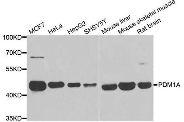 PPM1A Antikörper  (AA 1-382)