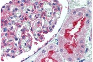 Human Kidney (formalin-fixed, paraffin-embedded) stained with ATG7 antibody ABIN305896 at 5 ug/ml followed by biotinylated goat anti-rabbit IgG secondary antibody ABIN481713, alkaline phosphatase-streptavidin and chromogen. (ATG7 antibody  (N-Term))