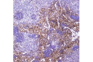 IHC analysis of VCAM1 using anti-VCAM1 antibody . (VCAM1 antibody  (AA 25-270))