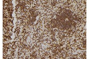 ABIN6277184 at 1/100 staining Rat spleen tissue by IHC-P. (TOLLIP antibody  (Internal Region))