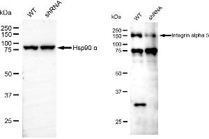 Western blotting analysis using Integrin alpha 5 antibody (ABIN7799076).