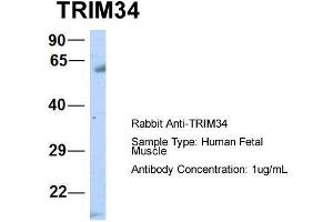 Host:  Rabbit  Target Name:  TRIM34  Sample Type:  Human Fetal Muscle  Antibody Dilution:  1. (TRIM34 antibody  (N-Term))