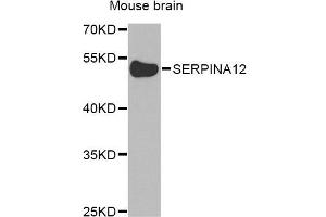 Western blot analysis of extracts of mouse brain, using SERPINA12 Antibody (ABIN5975254) at 1/1000 dilution. (SERPINA12 antibody)