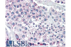 ABIN190875 (5µg/ml) staining of paraffin embedded Human Testis. (GPSM2 antibody  (Internal Region))