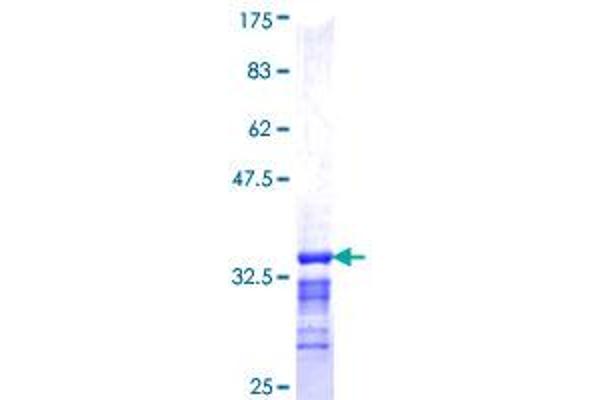 KLHL3 Protein (AA 1-65) (GST tag)