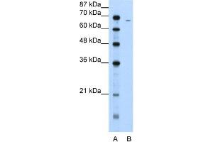 WB Suggested Anti-FGA Antibody Titration:  5. (FGA antibody  (N-Term))