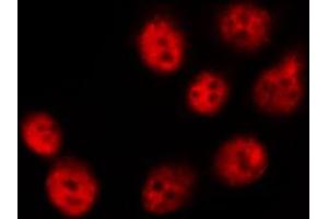 ABIN6267554 staining NIH-3T3 by IF/ICC.