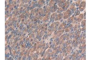 IHC-P analysis of Mouse Stomach Tissue, with DAB staining. (SLIT3 antibody  (AA 1348-1517))