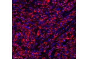 Immunofluorescence of paraffin embedded human lymphoma using septin1 (ABIN7074453) at dilution of 1: 650 (400x lens) (LARP1 antibody)