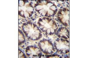 LNX2 Antibody (C-term) (ABIN656995 and ABIN2846175) immunohistochemistry analysis in formalin fixed and paraffin embedded human rectum tissue followed by peroxidase conjugation of the secondary antibody and DAB staining. (LNX2 antibody  (C-Term))