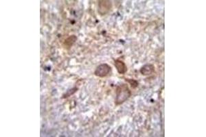 anti-Sperm Antigen with Calponin Homology and Coiled-Coil Domains 1 (SPECC1) (AA 712-741), (Middle Region) antibody