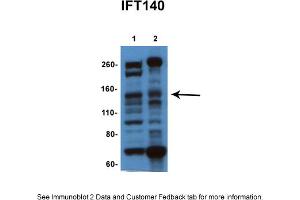 Sample Type: 1. (IFT140 antibody  (N-Term))