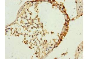 Immunohistochemistry of paraffin-embedded human testis tissue using ABIN7159905 at dilution of 1:100 (TIMM23 antibody  (AA 1-209))