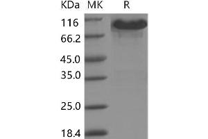 Western Blotting (WB) image for EPH Receptor A3 (EPHA3) (Active) protein (Fc Tag) (ABIN7195519) (EPH Receptor A3 Protein (EPHA3) (Fc Tag))