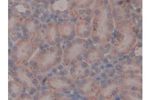 Immunohistochemistry (IHC) image for anti-Mucin 1 (MUC1) (AA 404-655) antibody (ABIN7429049)