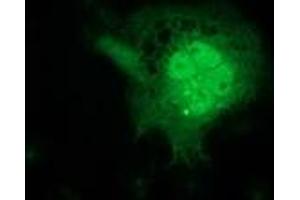 Anti-FGF21 mouse monoclonal antibody (ABIN2454488) immunofluorescent staining of COS7 cells transiently transfected by pCMV6-ENTRY FGF21 (RC204538). (FGF21 antibody  (AA 29-209))