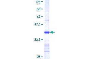 CSAD Protein (AA 1-98) (GST tag)