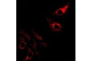 Immunofluorescent analysis of SPINK1 staining in Hela cells. (SPINK1 antibody)