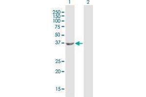 Western Blot analysis of HDAC8 expression in transfected 293T cell line by HDAC8 MaxPab polyclonal antibody. (HDAC8 antibody  (AA 1-377))