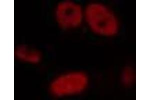 ABIN6274448 staining HepG2 cells by IF/ICC. (GTF3C2 antibody  (N-Term))