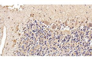 Detection of GLb in Human Cerebellum Tissue using Polyclonal Antibody to Galactosidase Beta (GLb) (GLB1 antibody  (AA 68-219))