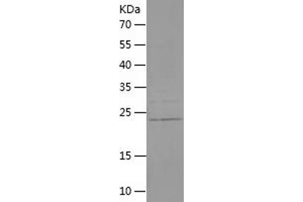 FGF8 Protein (AA 53-233) (His tag)