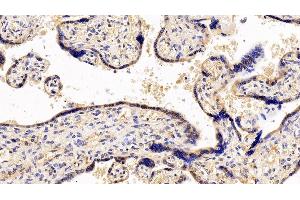 Immunohistochemistry (IHC) image for anti-Colony Stimulating Factor 3 Receptor (Granulocyte) (CSF3R) (AA 271-428) antibody (ABIN7438049)