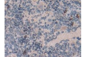 Detection of EMILIN1 in Rat Spleen Tissue using Polyclonal Antibody to Elastin Microfibril Interface Located Protein 1 (EMILIN1) (Emilin1 antibody  (AA 684-899))