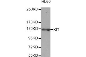 Western blot analysis of extracts of HL-60 cells, using KIT antibody (ABIN3049466). (KIT antibody)