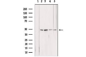 Western blot analysis of extracts from various samples, using ATPB antibody. (ATP5B antibody  (Internal Region))