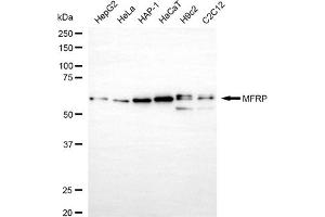 anti-Membrane Frizzled-Related Protein (MFRP) antibody